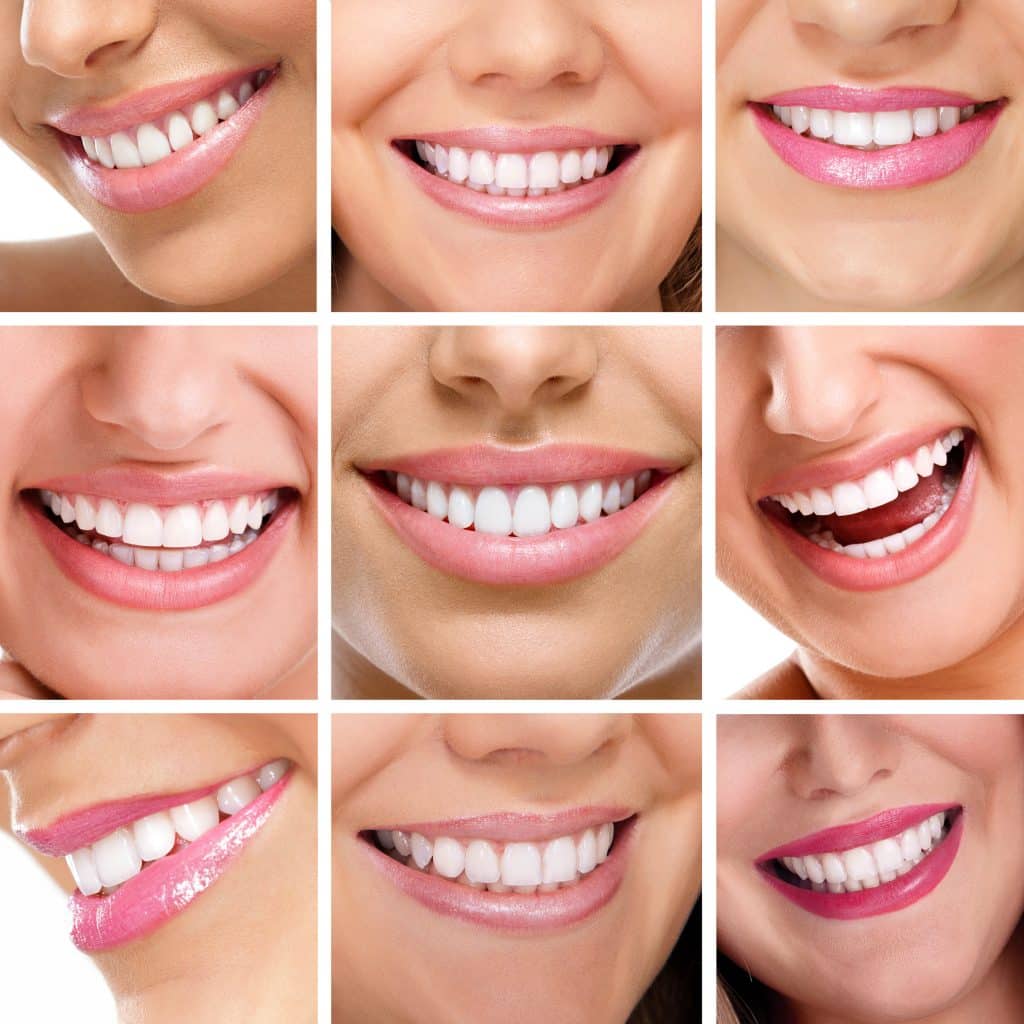 Cosmetic Dentistry / Restoration
