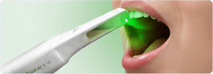 Oral Cancer Screening with VELscope